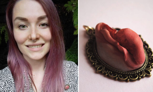 Kvinner sender bilder av underlivet sitt til Trine (24). Dette er resultatet