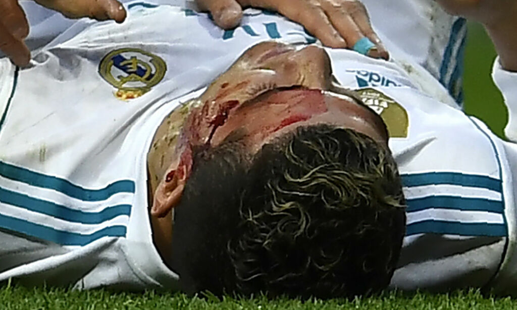 Ronaldo sparket til blods da Real Madrid knuste Deportivo